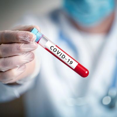 Korona virus u Srbiji: 266 novozaraženih, 11 preminulo