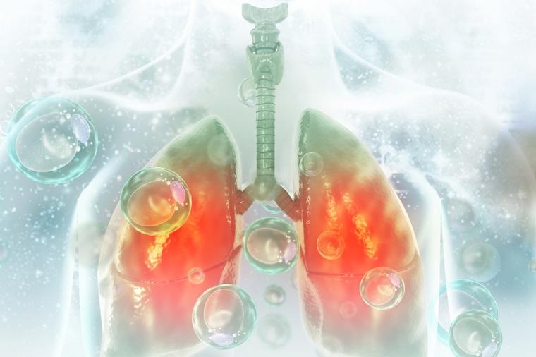 OVU PROMENU NA TELU NE SMETE IGNORISATI: To može biti najraniji znak da rak pluća razara vaš organizam!
