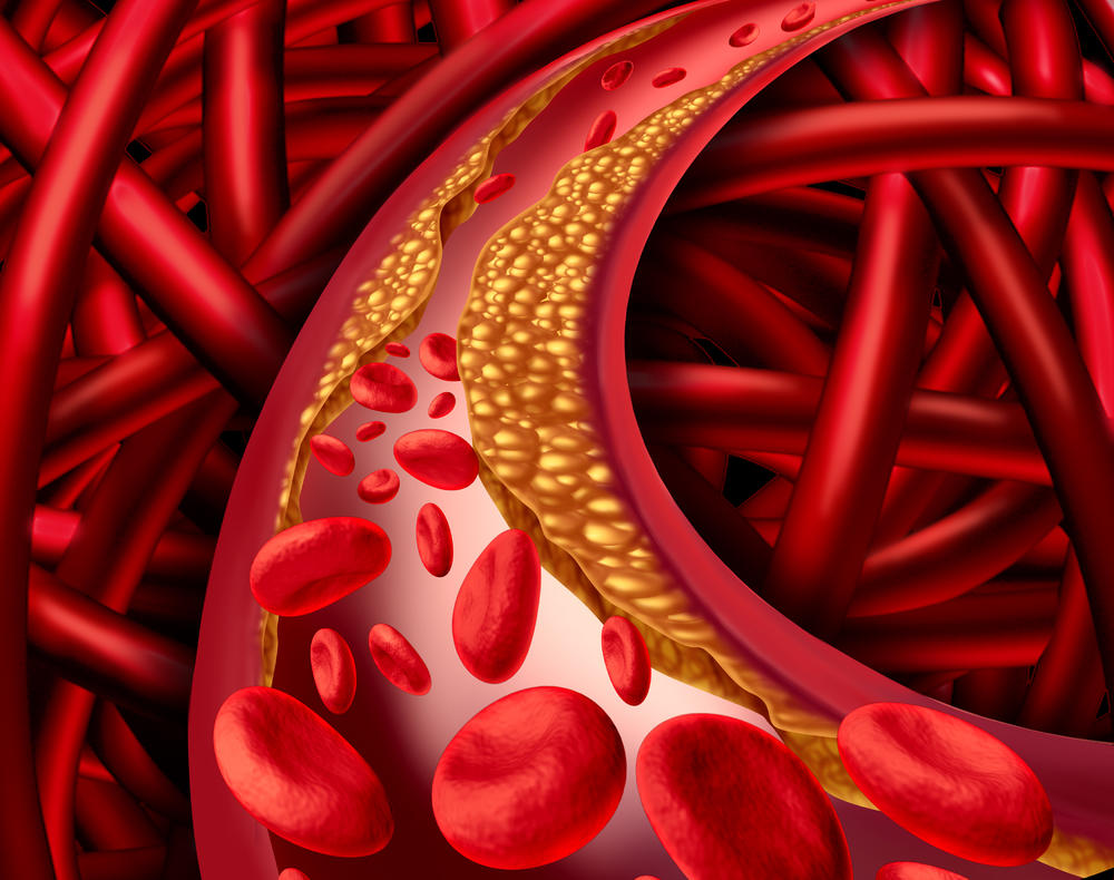 arterije, krvni sudovi