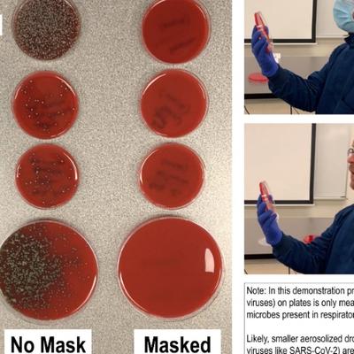 Mikrobiolog dokazao šta tačno radi zaštitna maska: Fotografije jasno pokazuju sve!