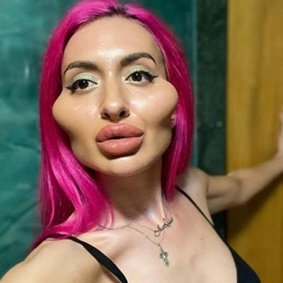 Anastasija (31) sama lice puni filerima: Momci obožavaju moj izgled, mnogo mi više prilaze! (FOTO)