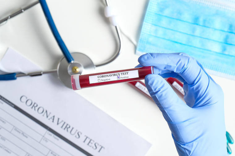 Korona virus u Srbiji: 2.518 novozaraženih, preminulo 16 pacijenata!
