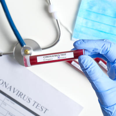 Korona virus u Srbiji: Testirano 7.848 osoba od kojih je 77 pozitivno