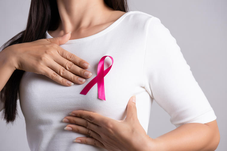 Sve žene znaju da su kvržice glavni simptom raka dojke: Ali i ovo su znaci za uzbunu!