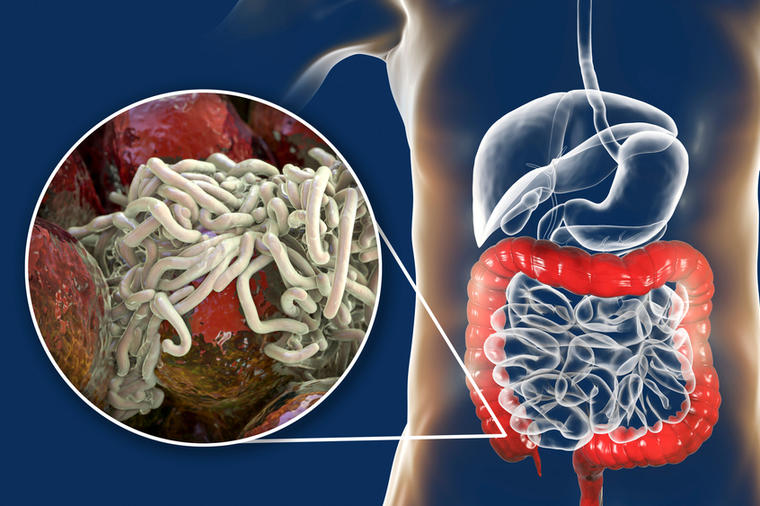 Parazitozele intestinale: capcane de diagnostic și tratament