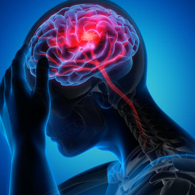 GENIJALAN TRIK NEUROHIRURGA: Sprečava propadanje mozga, smanjuje rizik od Alchajmera, poboljšava pamćenje!