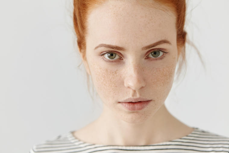 Ove promene na licu mogu da ukazuju na ozbiljne zdravstvene tegobe: Ne ignorišite signale koje telo šalje!