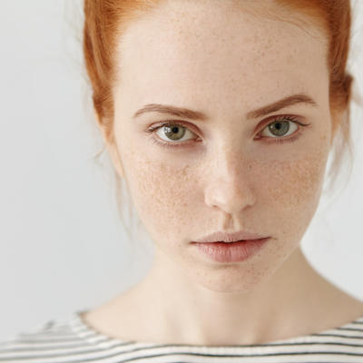 Ove promene na licu mogu da ukazuju na ozbiljne zdravstvene tegobe: Ne ignorišite signale koje telo šalje!