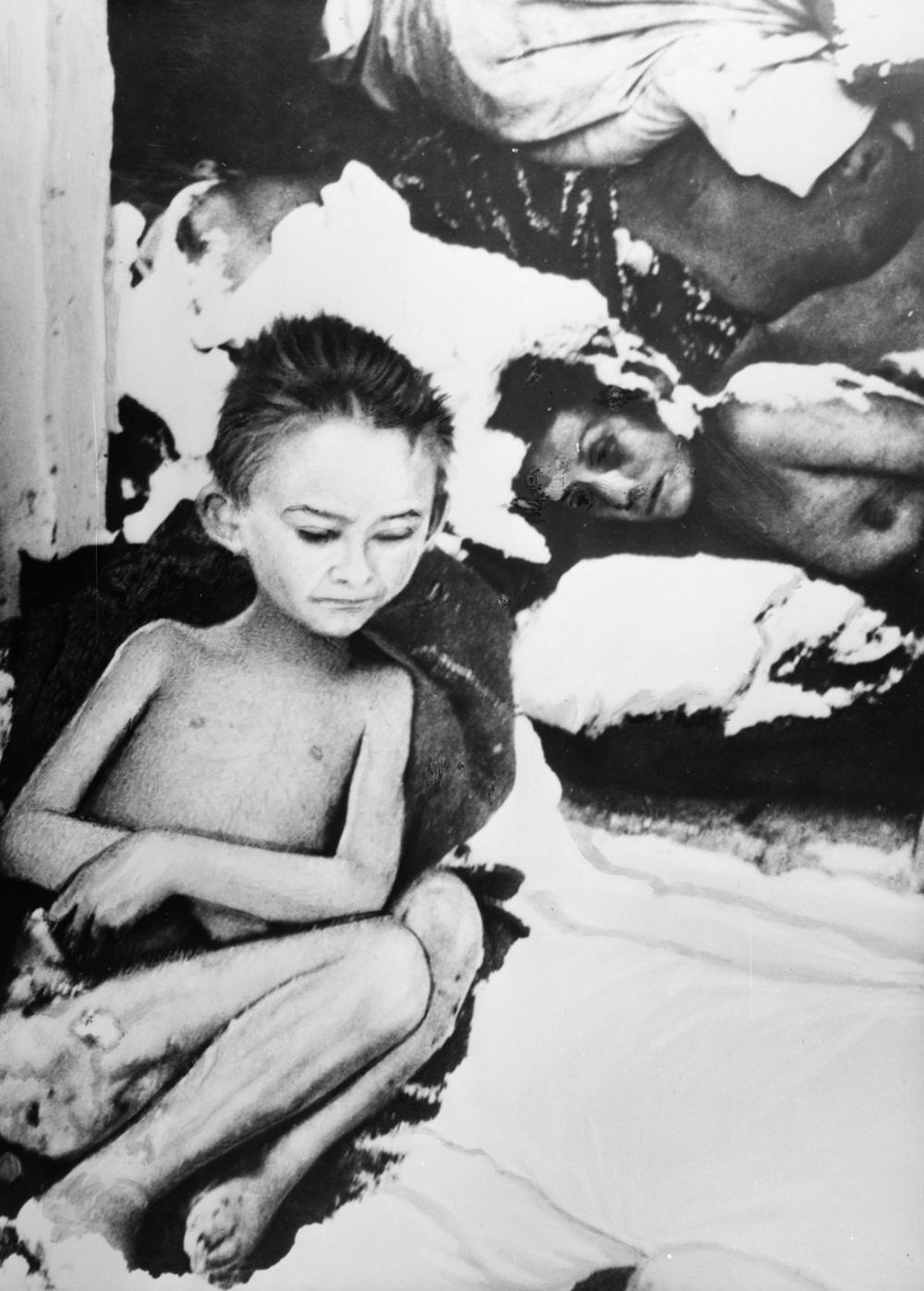 Žrtve dr Mengelea u Aušvicu 