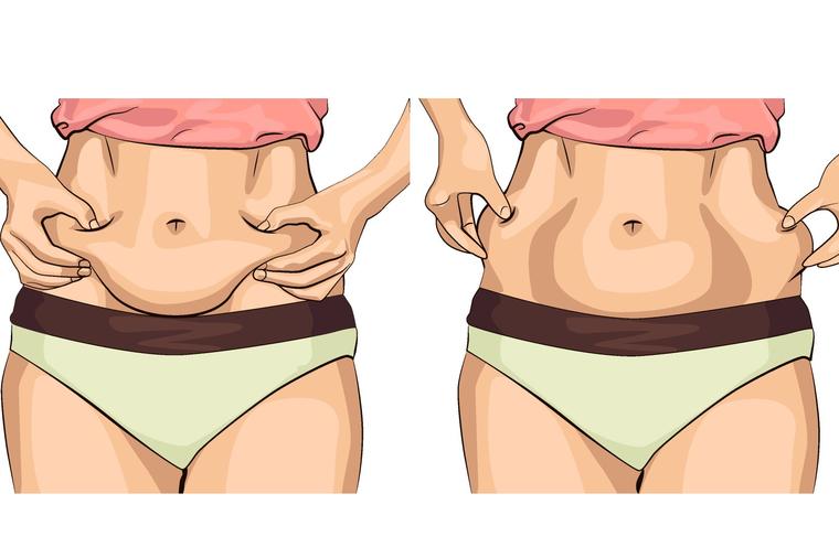 Kako da zategnete kožu na stomaku posle gubitka kilograma ili porođaja: 9 najvažnijih pravila!