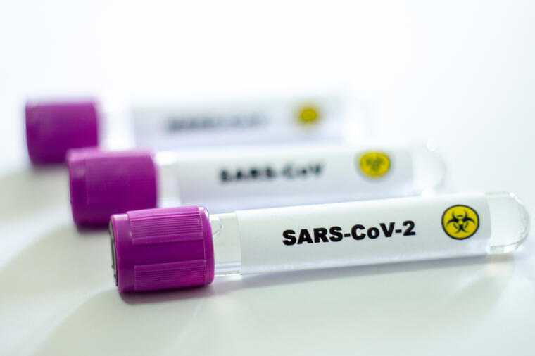 KORONA VIRUS U SRBIJI: 3.219 novozaraženih, preminulo 55 pacijenata