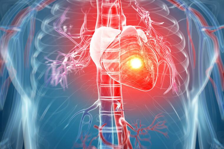 KARDIOHIRURG STOJANOVIĆ: Kad se pojavi prvi simptom ove srčane bolesti, kasno je za lekove! Jedina opcija je operacija!
