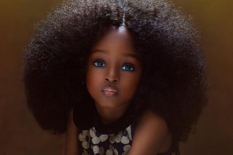 KAD JE IMALA 5 GODINA, OPČINILA JE SVET NESTVARNOM LEPOTOM: Kako danas izgleda najlepša Nigerijka sa plavim očima? FOTO