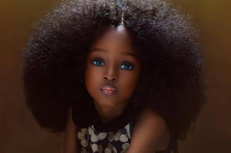 VIŠE ANĐEO, NEGO LJUDSKO BIĆE: Ovako sad izgleda Nigerijka, koja je sa 5 godina postala najlepša devojčica na svetu!FOTO