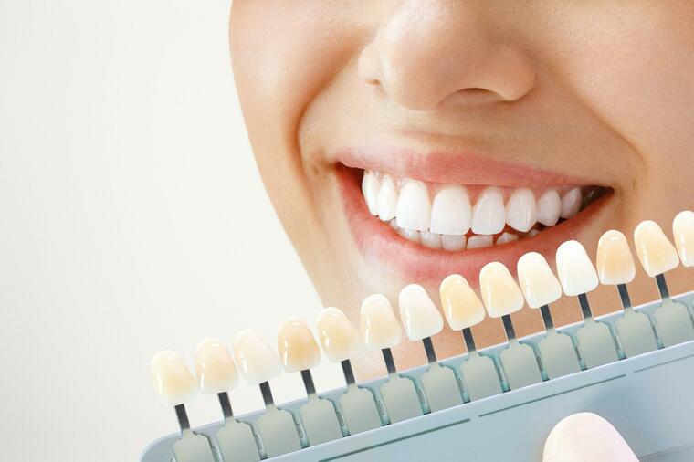 BRZO I EFIKASNO DO BLISTAVOG OSMEHA: Na ovaj način možete sami da vratite belinu vaših zuba!