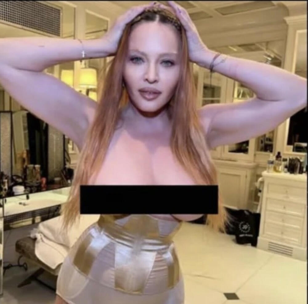 Madona je objavila fotografiju golih grudi  
