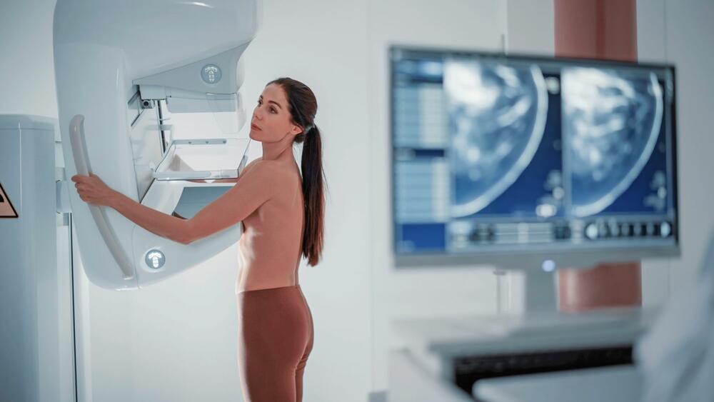 mamografija, mamograf