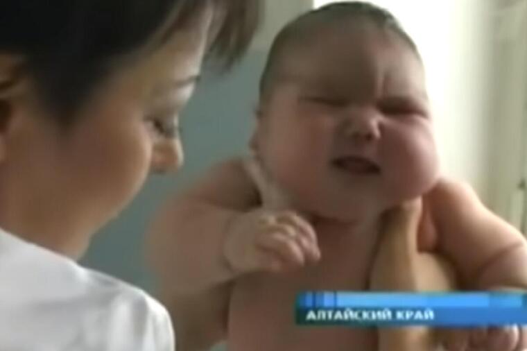 Nađa je bila najveća beba na svetu rođena s čak 8 kg: U životu je svašta doživela, šokiraćete se kad vidite kako izgleda